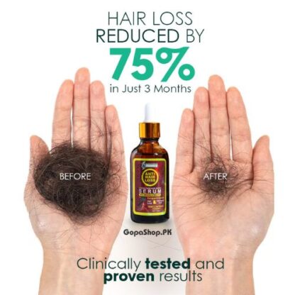 Anti Hair Loss Serum With Ginseng & Procapil results