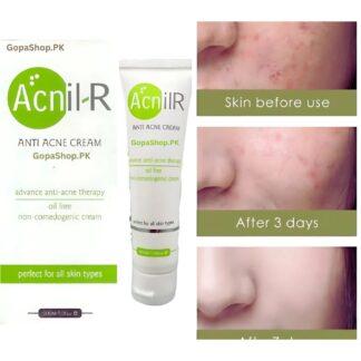 AcnilR Anti Acne Cream