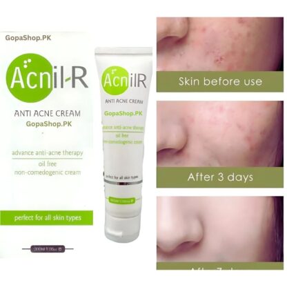 AcnilR Anti Acne Cream