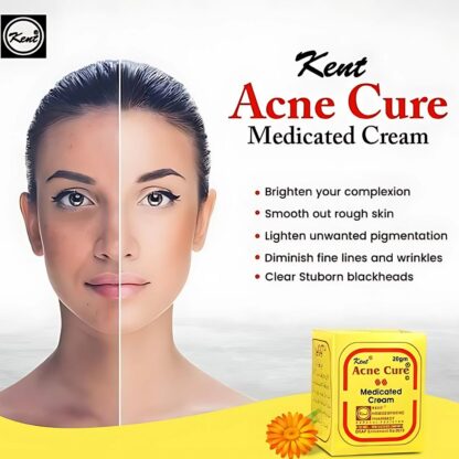 Kent Acne Cure Cream (2)